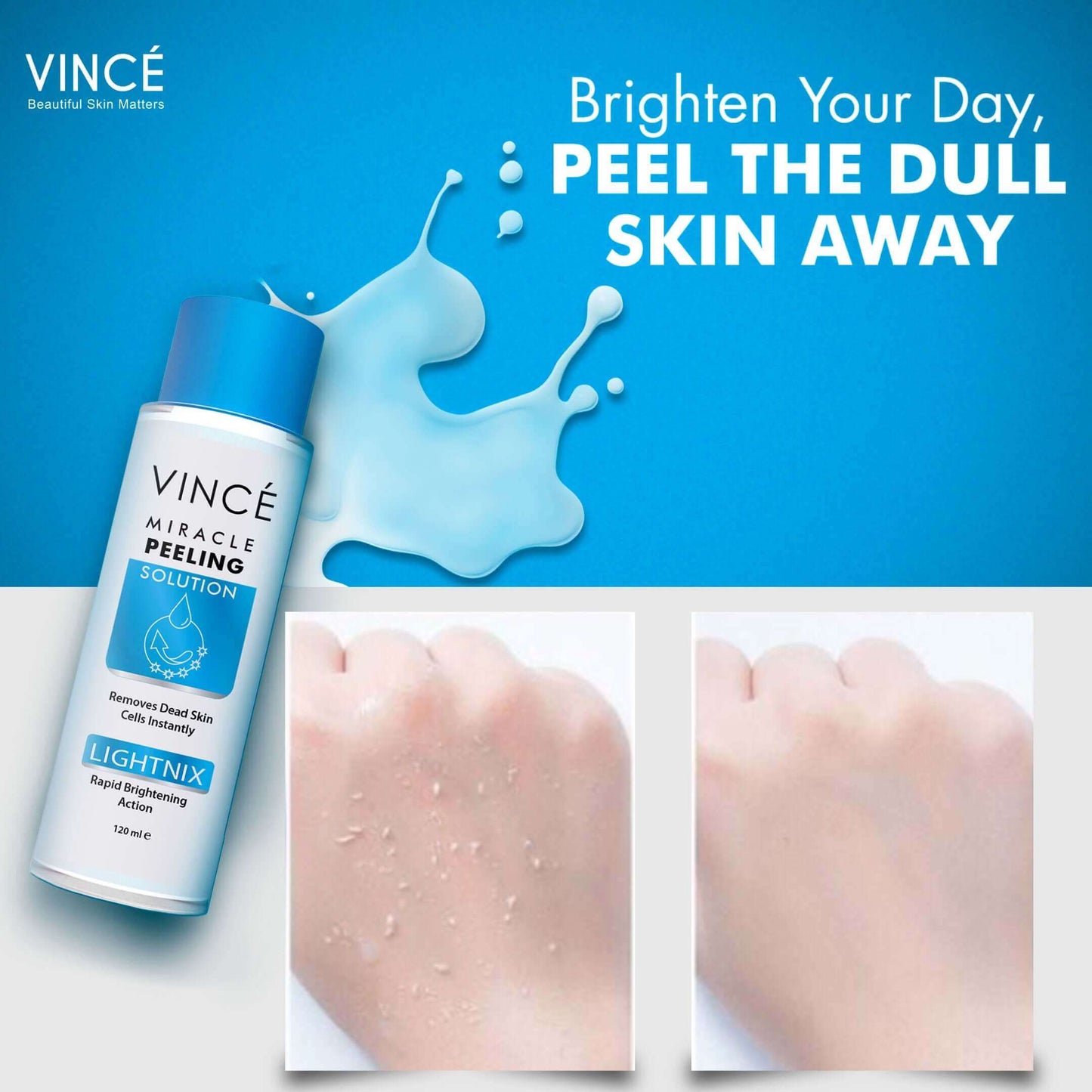 Vince - Miracle Peeling Solution - 120ml texture gel cream