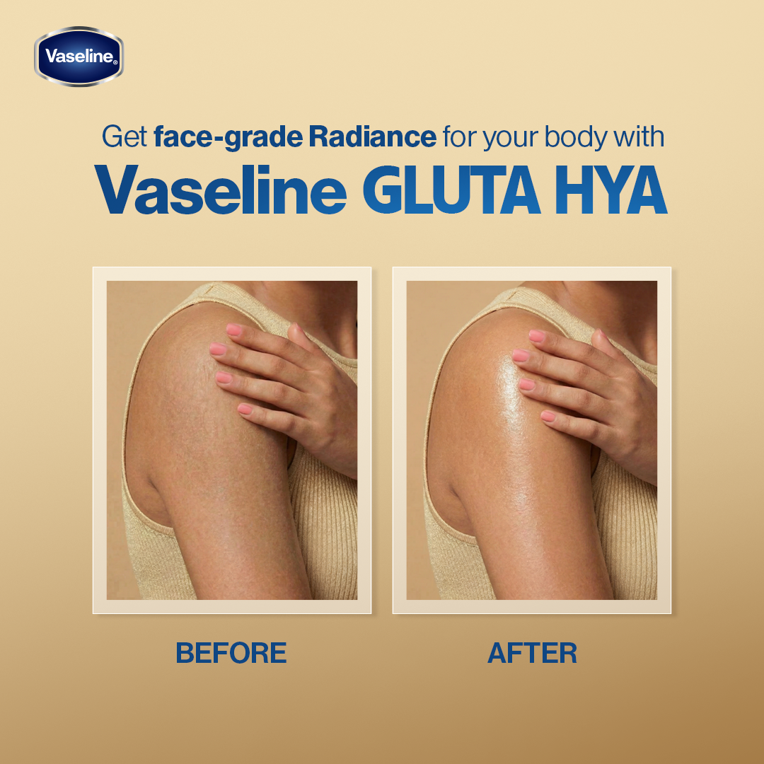 Vaseline - Gluta Hya Flawless Glow Serum - 70ml before after skin results