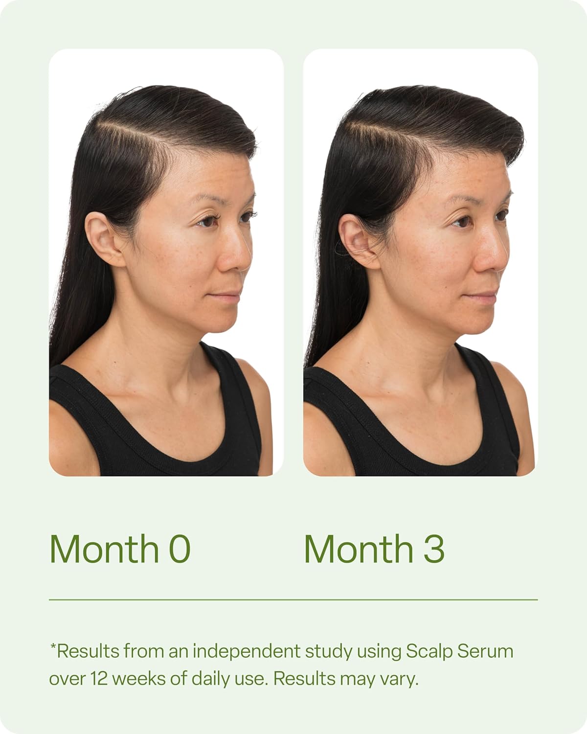 Divi Scalp Serum