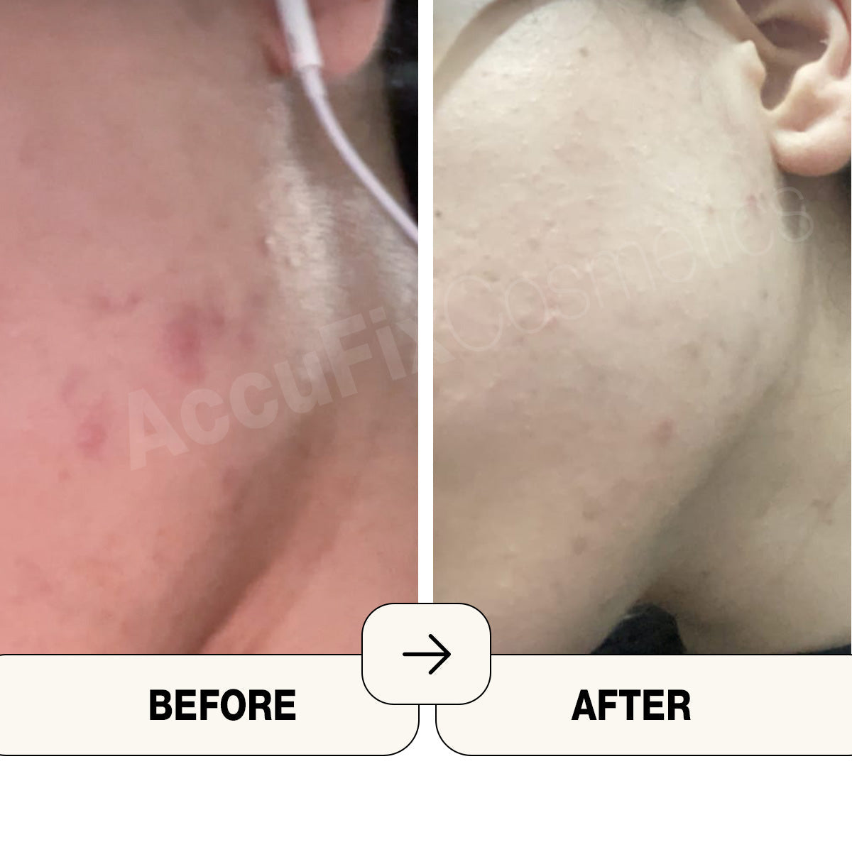AccuFix - Salicylic Acid Face Wash Gel ingredients label