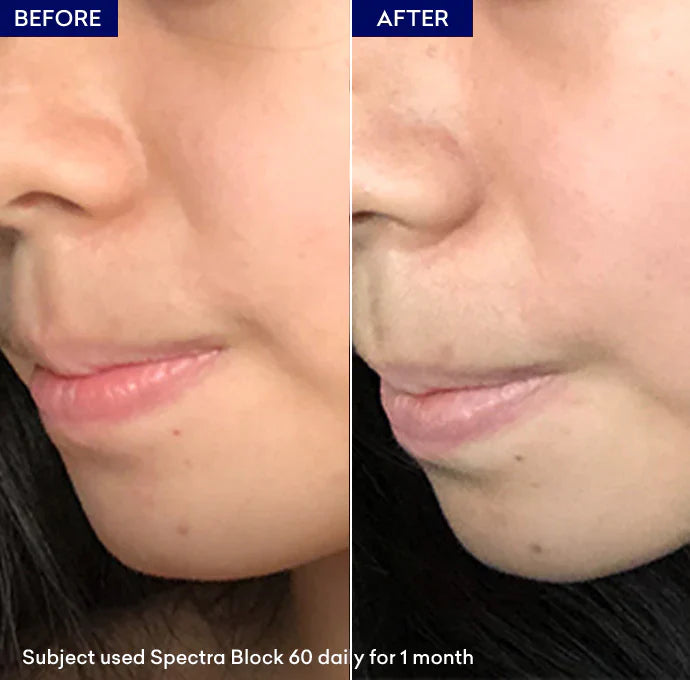 Jenpharm Spectra Block Broad Spectrum Sun Block Cream 40G before after skin results