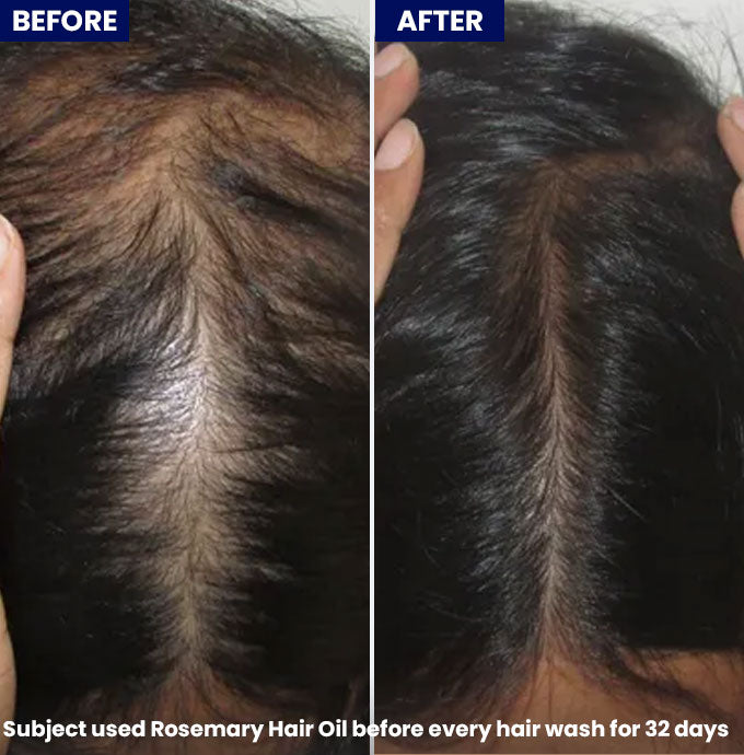 Jenpharm - Anagrow Rosemary Hair Oil before after skin results