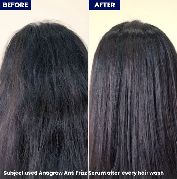Jenpharm - Anagrow Anti Frizz Hair Serum before after skin results