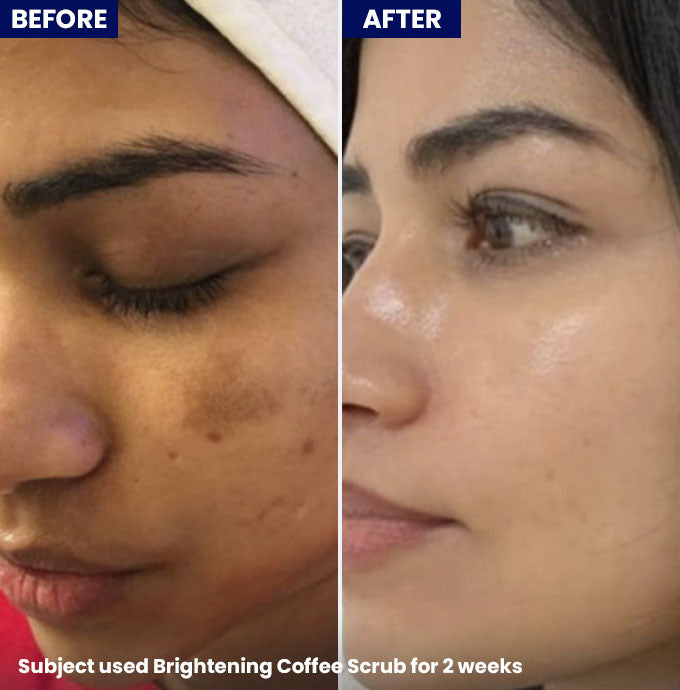 Jenpharm - Brightening Coffee Scrub before after skin results